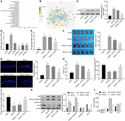 SOX9 Knockdown-Mediated FOXO3 Downregulation Confers Neuroprotection Against Ischemic Brain Injury